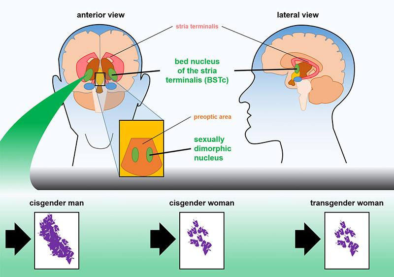 Image: Understanding our brain